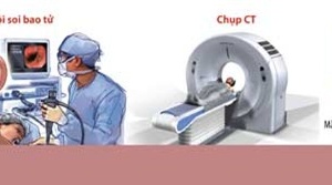 Làm thế nào chẩn đoán bệnh ung thư?