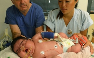 Chớ thấy bé sơ sinh nặng ký mà mừng