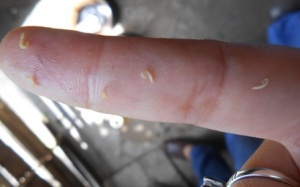 Tiền Giang: Chăm sóc nha khoa bằng cách bắt 'con sâu răng'