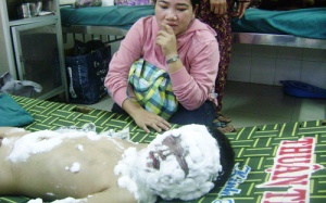 Bé 5 tuổi bị bỏng do nổ tủ điện