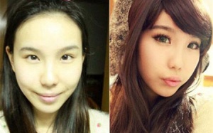 Bệnh viện quá tải vì... giới trẻ đua nhau 'tút tát'