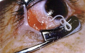 'Điểm danh' những loài ký sinh ghê rợn nhất hành tinh