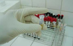 Sai lệch “chết người” trong xét nghiệm: Chưa có labo xét nghiệm trọng tài