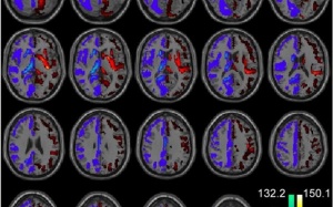 Phát hiện gây shock về người não trái và người não phải