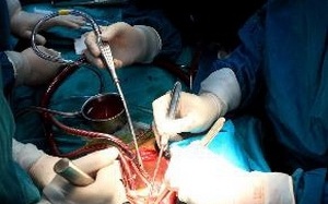 Cứu sống bệnh nhân phồng lóc động mạch chủ nặng