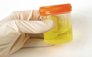 Xét nghiệm nước tiểu cũng bị 'nhân bản'