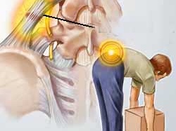 Cốt Thoái Vương có thể chữa đau lưng không?