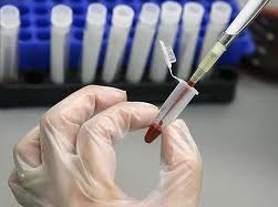 Phát hiện nguy cơ tự tử từ xét nghiệm máu