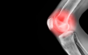 Giữ cho sụn khớp đừng mòn