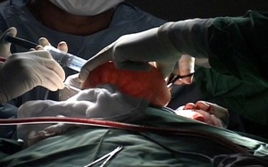 Phẫu thuật cắt bỏ đầu thừa cho em bé mắc bệnh lạ