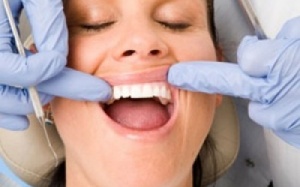 Tác nhân làm răng 'rung rinh'