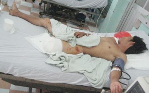 Cứu bệnh nhân bị xay nát chân và bộ phận sinh dục