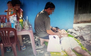 Cẩn trọng với châm cứu dạo!