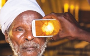 Khám mắt bằng... smart phone