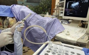 Đài Loan: Chuộng đông lạnh trứng để trì hoãn sinh con