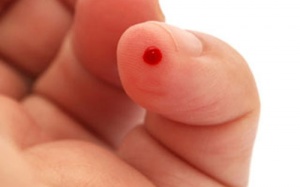 Bé sơ sinh hôn mê sau khi bị cắt lể