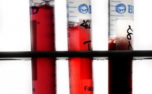 Điều trị ung thư bằng liệu pháp miễn dịch sinh học