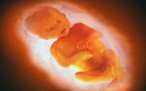 Trẻ trong bào thai nghe được tiếng động