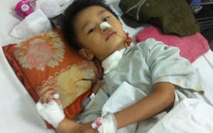 Thủng thực quản vì... ăn cá