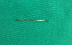 Cứu sống bệnh nhân bị kim đâm vào tim