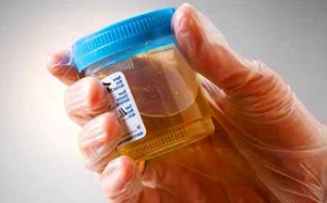 Những tiết lộ thú vị từ... nước tiểu