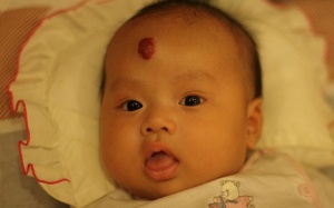 U máu, lành nhưng mệt