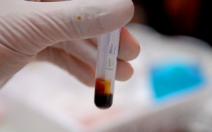 Xét nghiệm mới phát hiện sốt rét kháng thuốc