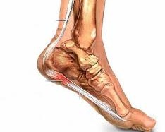 Đau gót chân - nghĩ ngay đến yếu thận