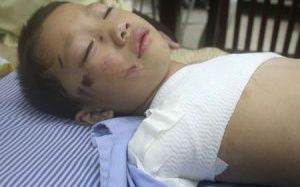 Bé 5 tuổi bị gấu nuôi cắn nát 2 tay