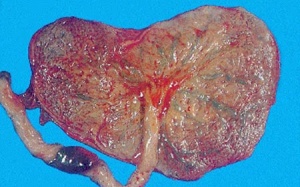 Thực hư về đồn đại 'nhau thai' đại bổ