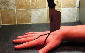 Phát hiện gene 'không biết đau'