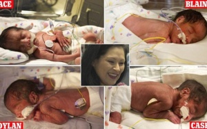 Song sinh - kết nối kỳ diệu và những chuyện lạ có thật