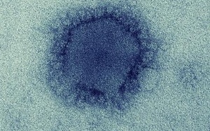Virus gây bệnh MERS từng lây từ động vật sang người