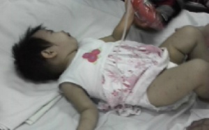 Liên tiếp các vụ tai nạn của trẻ nhỏ do cha mẹ bất cẩn.