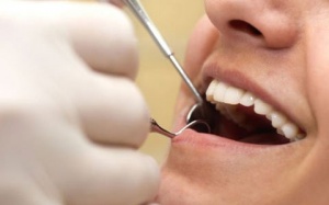 Bệnh nướu răng liên quan viêm khớp