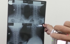 TPHCM: 2 bác sĩ thôi việc sau vụ phát hiện gian lận phim