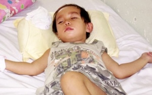 BV nhận 'thiếu sót' vụ bé 29 tháng tuổi bị mù và liệt