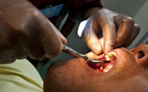 Tử vong vì nhiễm trùng răng