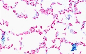 Chất cực độc bị giới khoa học che giấu 40 năm