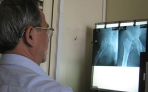 Phải thay khớp háng vì tin 'lang băm'