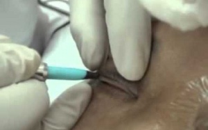 Đi làm đẹp, một phụ nữ bị thẩm mỹ viện vứt xác phi tang?