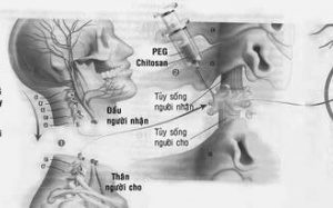 Ghép đầu - Quái dị hay hy vọng mới?
