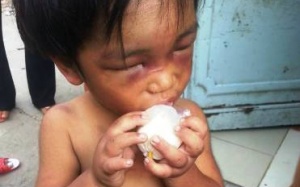 Giải cứu cháu bé ba tuổi bị bạo hành, ngược đãi