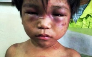 Cháu bé 3 tuổi bị bạo hành được mẹ đưa đi trốn?