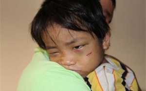 'Địa ngục trần gian' của cậu bé 3 tuổi bị bắt đi ăn xin