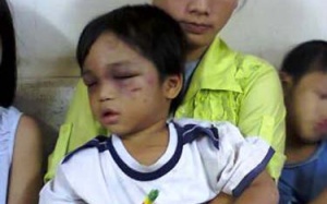 Vụ bé ba tuổi bị cậu đánh tàn nhẫn: Chỉ có thể cảnh cáo?