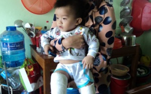 Dừng hoạt động cơ sở giữ trẻ làm bé gãy hai chân