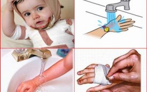 Khi trẻ bỏng gas, xử trí ban đầu là quan trọng nhất