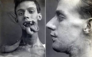 Những hình ảnh về phẫu thuật thẩm mỹ thủa sơ khai