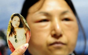 Phẫu thuật rẻ tiền: 17 già như 57